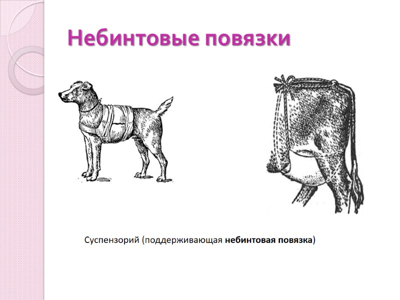 Небинтовые повязки Суспензорий (поддерживающая небинтовая повязка)
